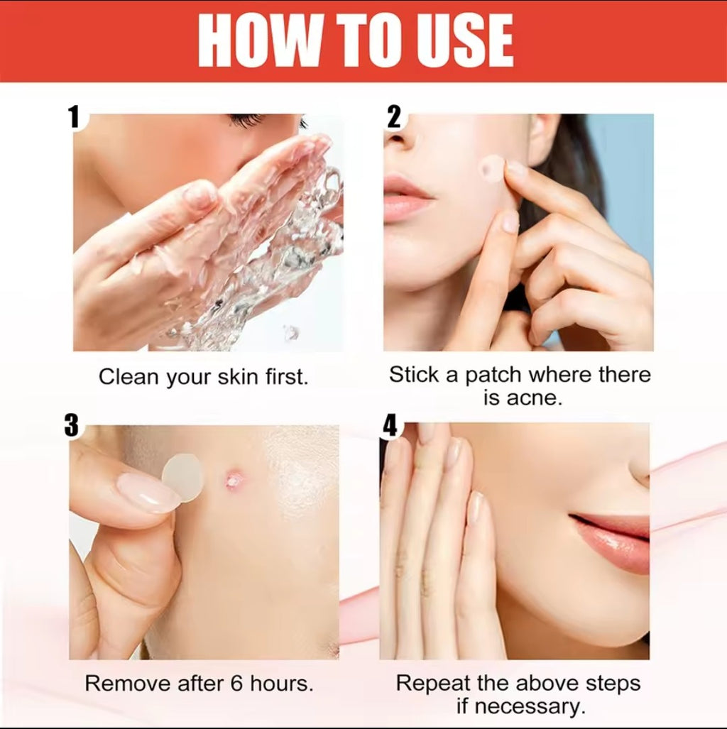 144-Count Hydrocolloid Acne Patches - Invisible Pimple & Blemish Spot Treatment, Fast Healing Absorbency Patches for Face