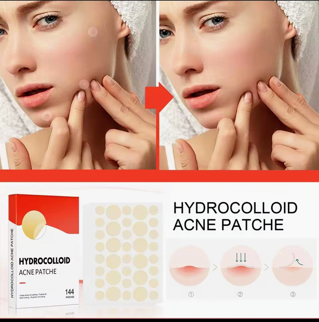 144-Count Hydrocolloid Acne Patches - Invisible Pimple & Blemish Spot Treatment, Fast Healing Absorbency Patches for Face